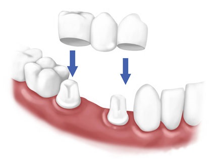 پروتز دندان کلینیک دندانپزشکی شبانه روزی