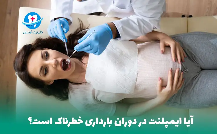 ایمپلنت دندان در بارداری