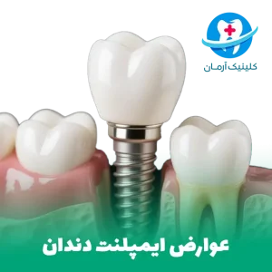 implant arman complications