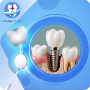 عوارض ایمپلنت دندان -لینیک ارمان فردیس