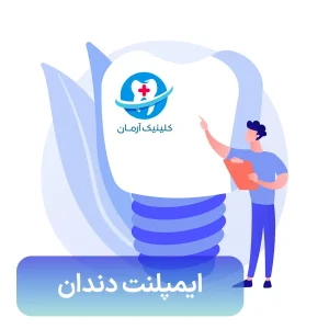 ایمپلنت در فردیس - ایمپلنت دندان