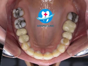 ارتودنسی نامرئی - متخصص ارتودنسی در فردیس