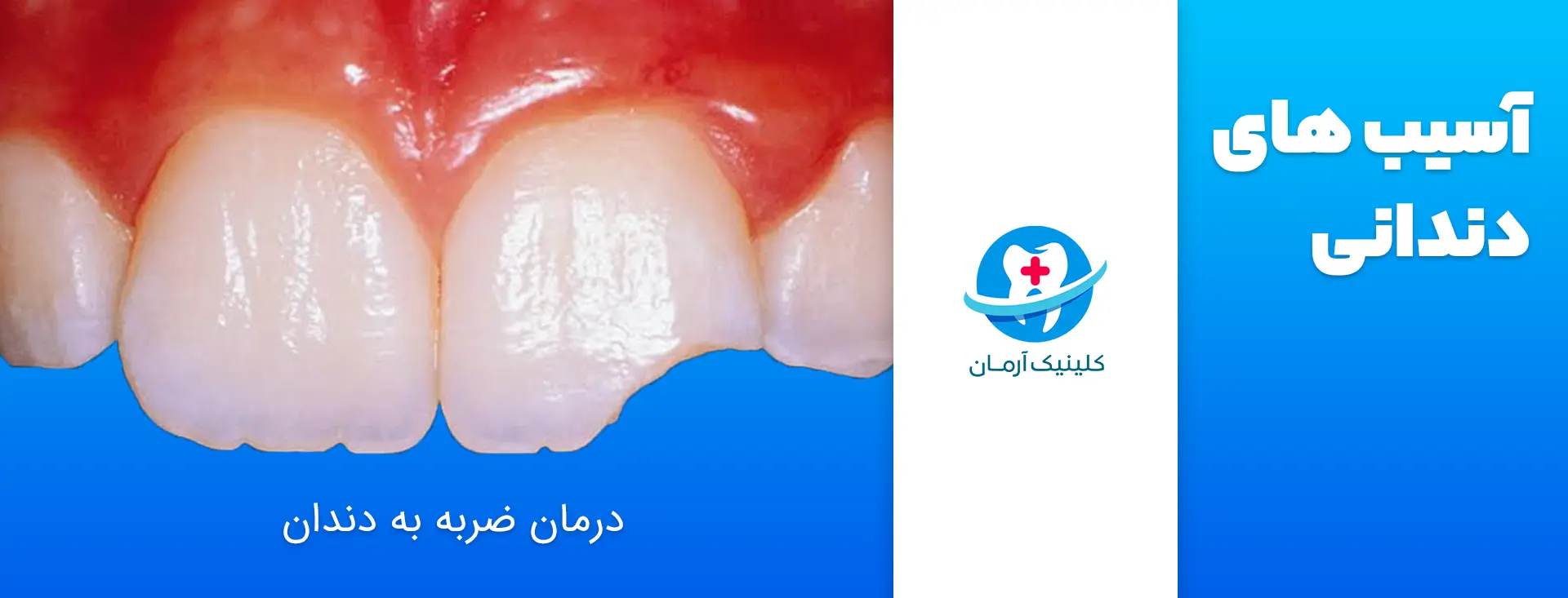 دندانپزشکی شبانه روزی کرج - کلینیک آرمان