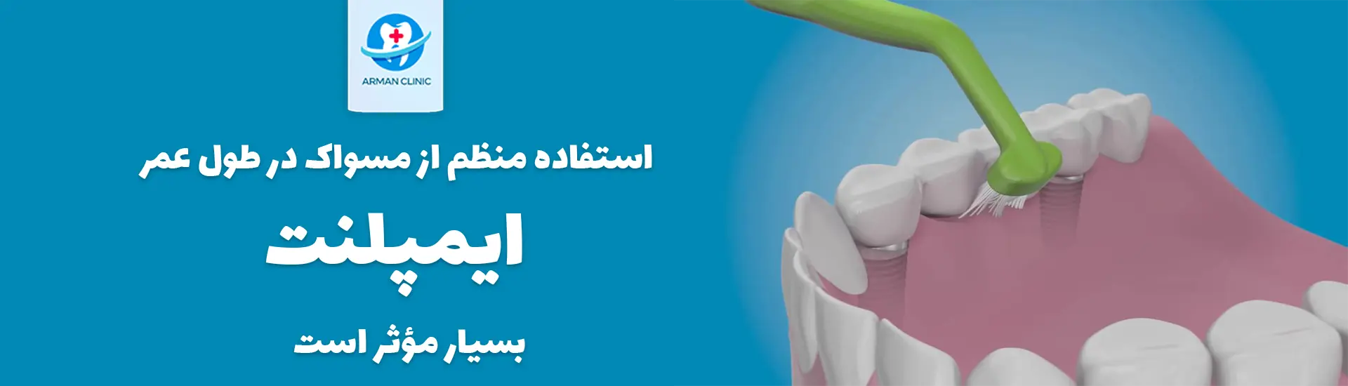 arman toothbrush implant c