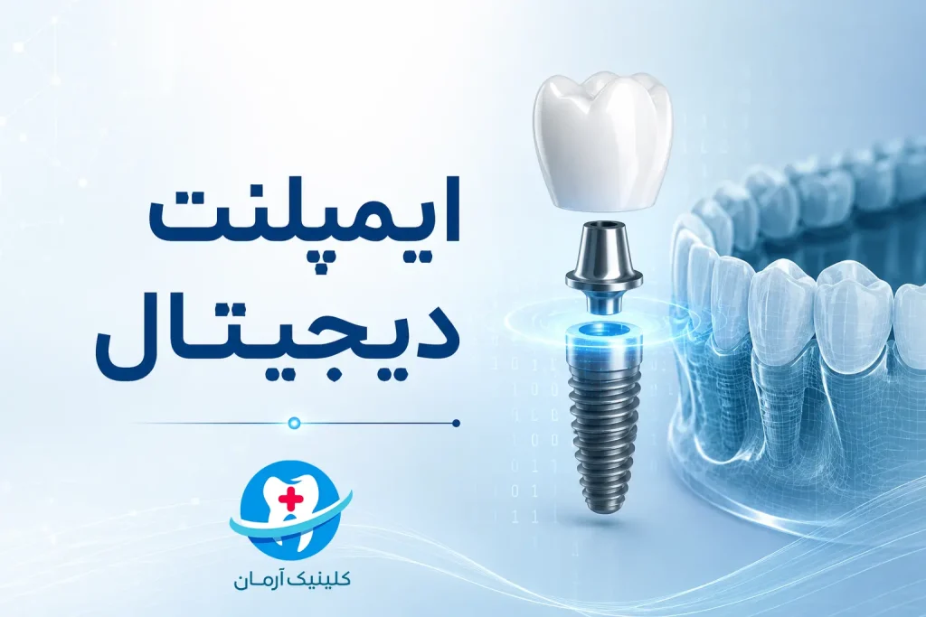 ایمپلنت دیجیتال در کرج و فردیس - کلینیک تخصصی ایمپلنت آرمان - ارائه خدمات شبانه روزی